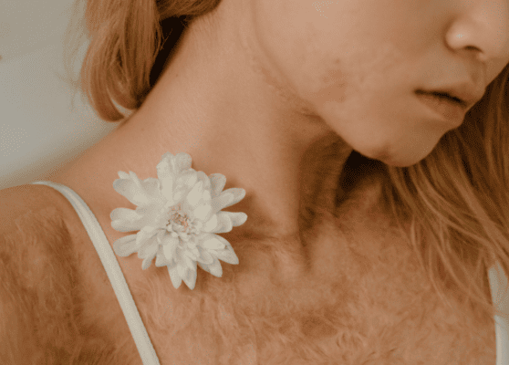 Scar Image